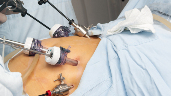 تكلفة عملية قص المعدة في سلطنة عمان